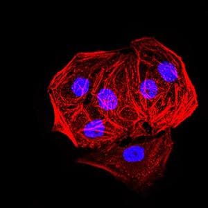 Monoclonal Mouse anti-Human EHMT2 / G9A Antibody (clone 2D12A11, IHC, WB)
