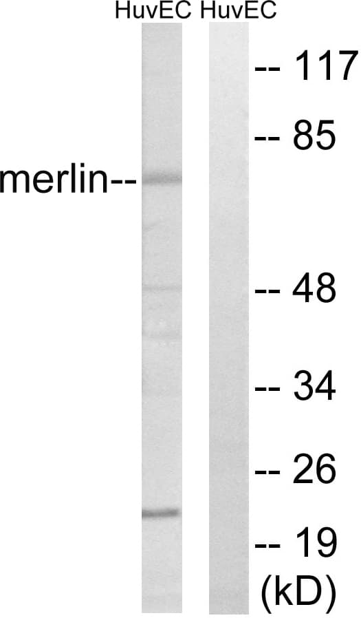 NF2 / Merlin Antibody (aa485-534)