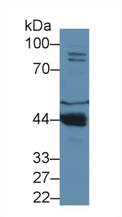 PON1 / ESA Antibody (APC)