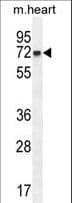 CCDC148 Antibody (aa279-307)