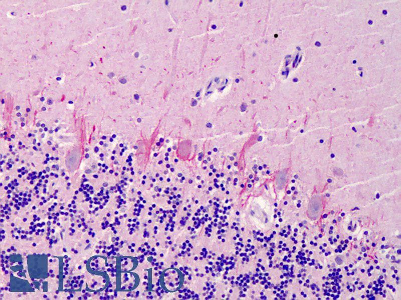 IHC-plus™ SUMO2 + SUMO3 Antibody (aa49-81)