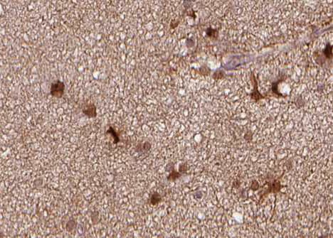 Polyclonal Rabbit anti-Human TNFRSF6B / DCR3 Antibody (IHC, IF, WB)
