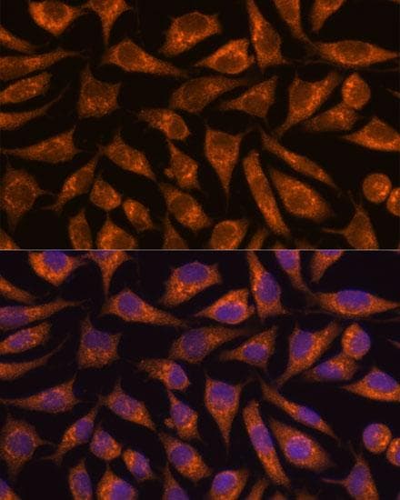 B3GNT4 Antibody