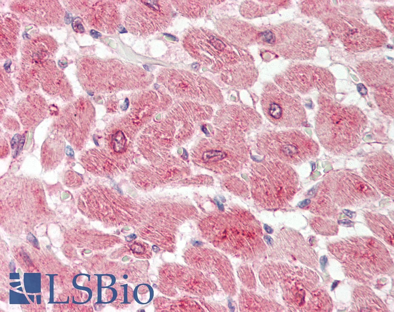 Polyclonal Rabbit anti-Human RPE Antibody (aa35-84, IHC, WB)