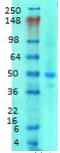 SLC38A1 / NaT2 Antibody (clone S104-32)