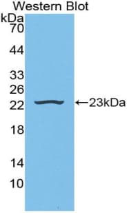 HP / Haptoglobin Antibody (aa159-329)