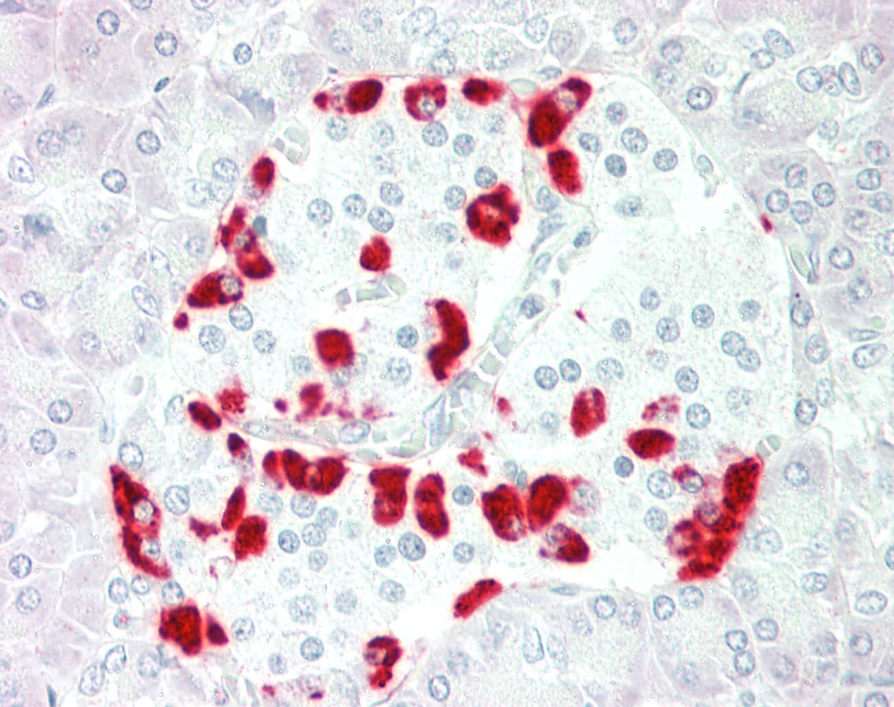 IHC-plus™ CASR/Calcium Sensing Receptor Antibody
