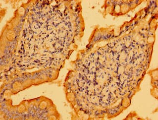 Polyclonal Rabbit anti-Human PSD Antibody (IHC, WB)