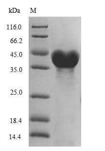 Colwellia psychrerythraea DNA Ligase Protein (Recombinant 10His, N-terminus)