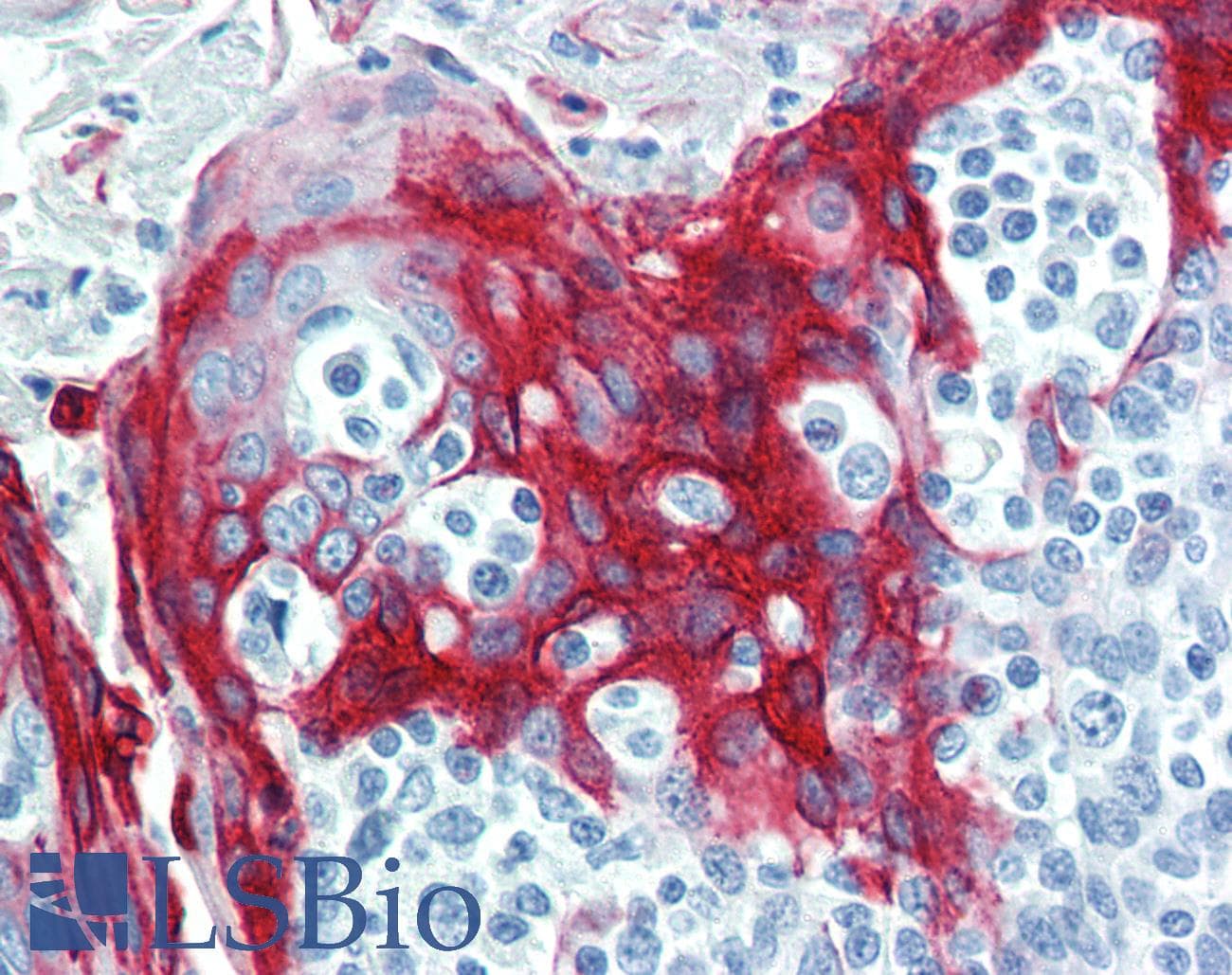 PathPlus™ Polyclonal Rabbit anti-Human KRT16 / CK16 / Cytokeratin 16 Antibody (clone R20-S, C-Terminus, IHC)