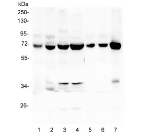LCP1 / L-Plastin Antibody