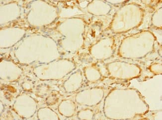 C8orf34 Antibody