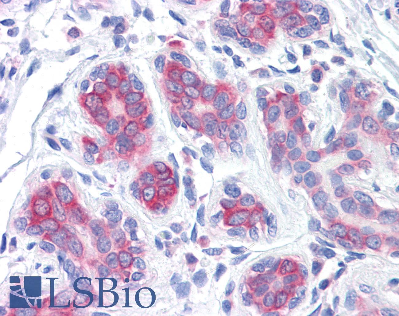 IHC-plus™ RPS2 / Ribosomal Protein S2 Antibody (clone 3G6)