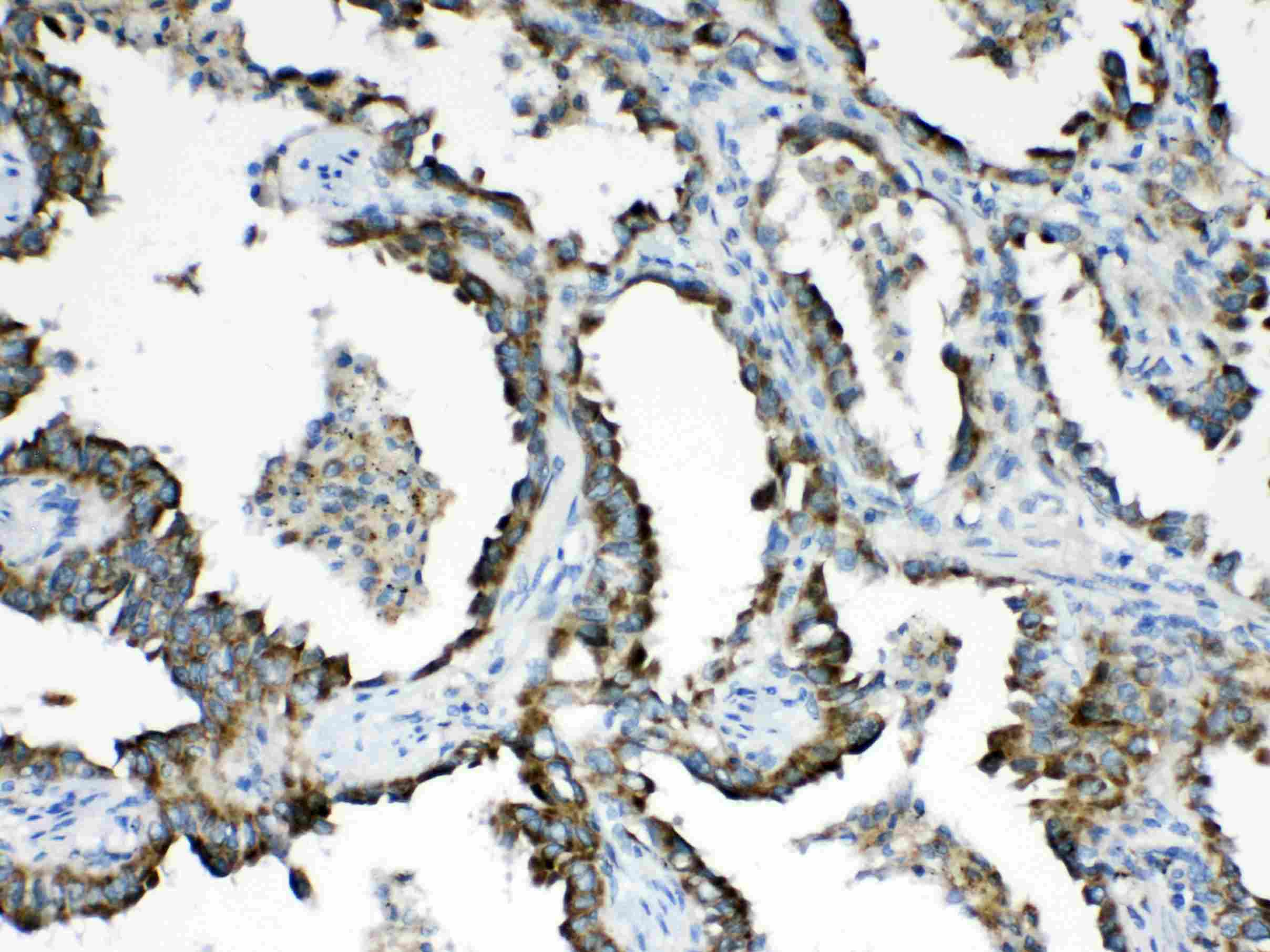 Polyclonal Rabbit anti-Human HSD17B4 Antibody (IHC, WB)