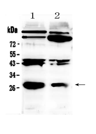 PDGF-BB Antibody