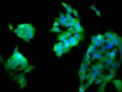 Polyclonal Rabbit anti-Human ASAH2 Antibody