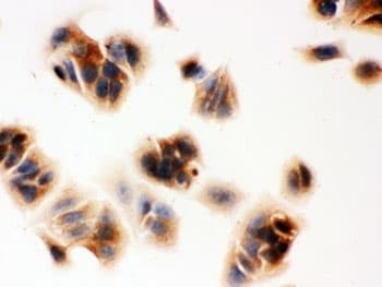 SERPINB5 / Maspin Antibody (aa1-350)