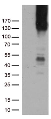 PECAM-1 / CD31 Antibody (clone UMAB164)