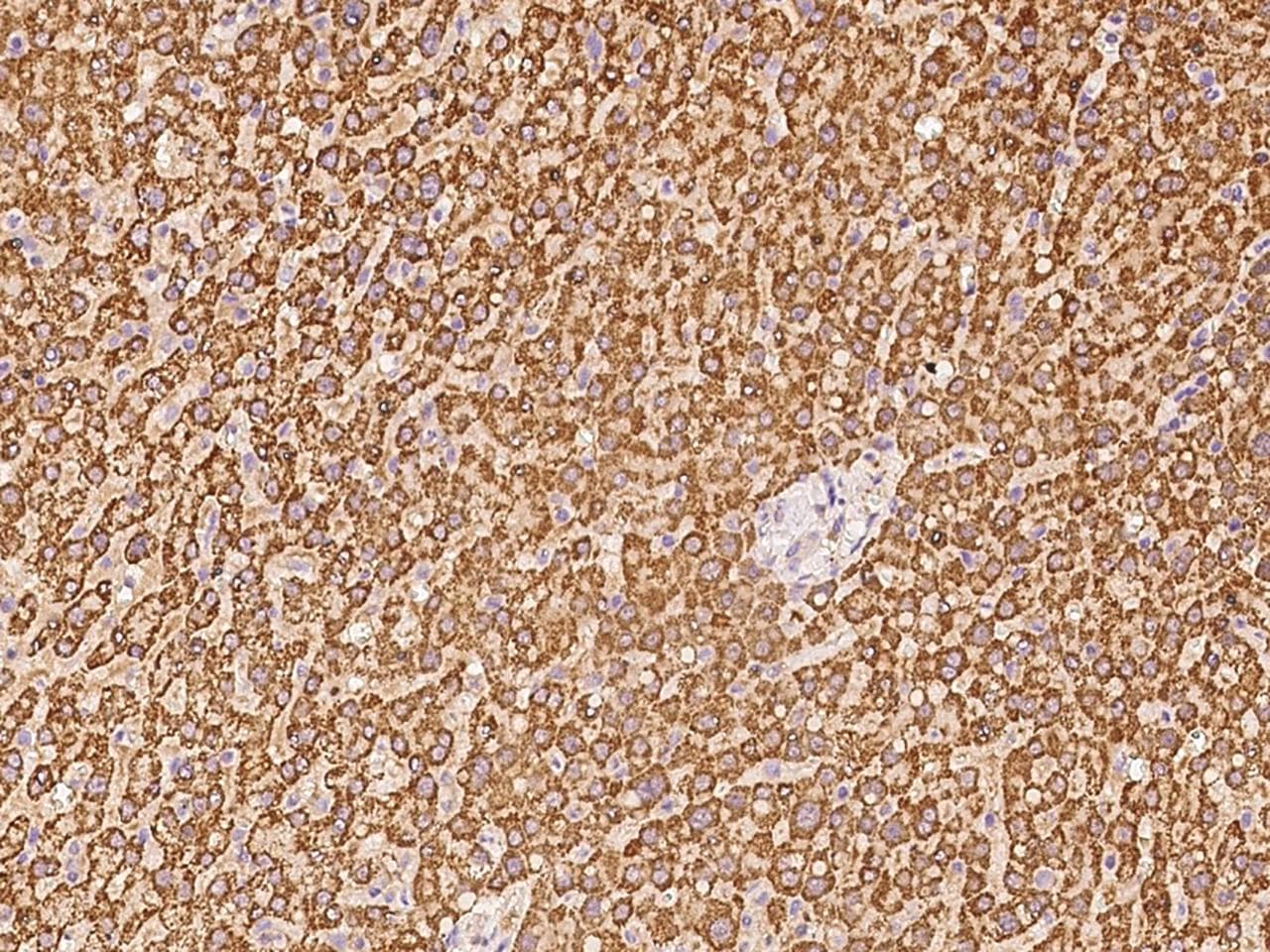 Polyclonal Rabbit anti-Human EIF3S5 / EIF3F Antibody (IHC, IF, WB)
