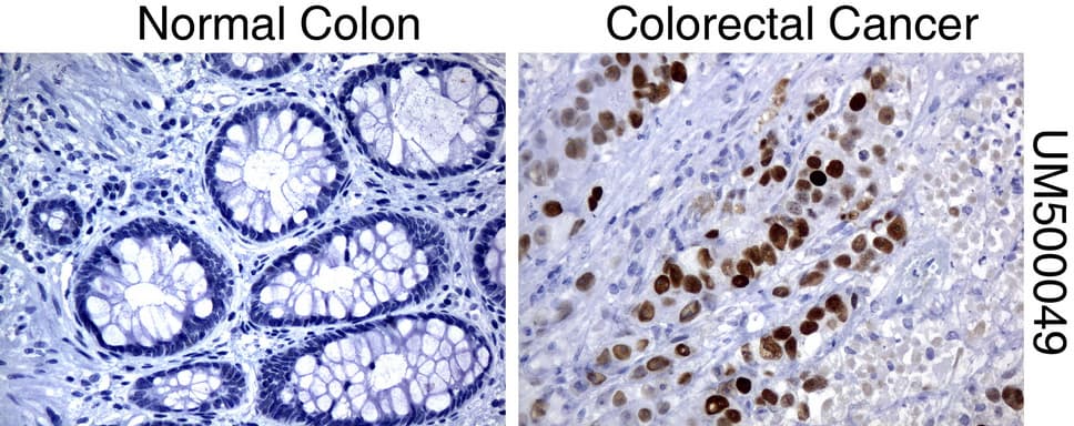 TP53 / p53 Antibody (clone UMAB55)