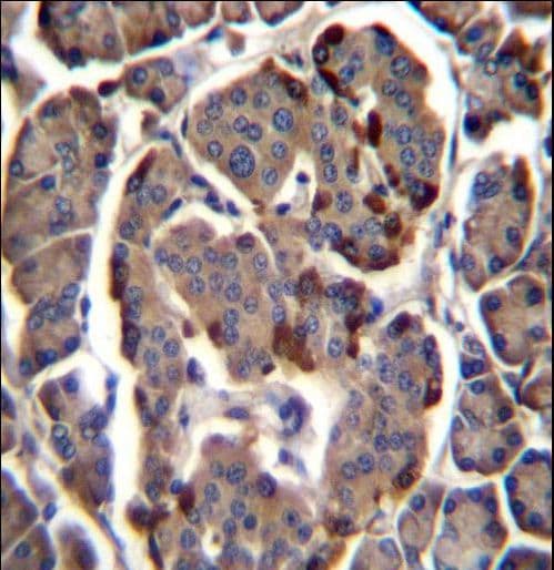 RAB11B Antibody (aa164-193)