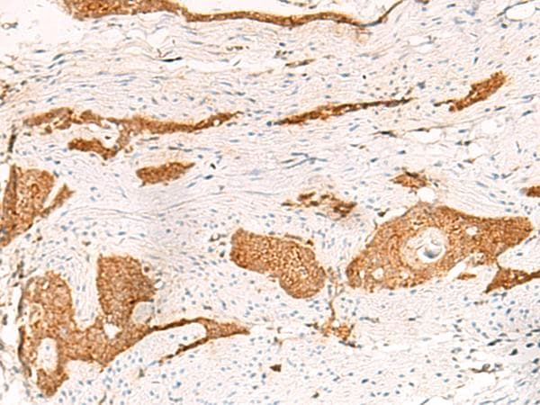 Polyclonal Rabbit anti-Human THNSL1 Antibody (IHC, WB)