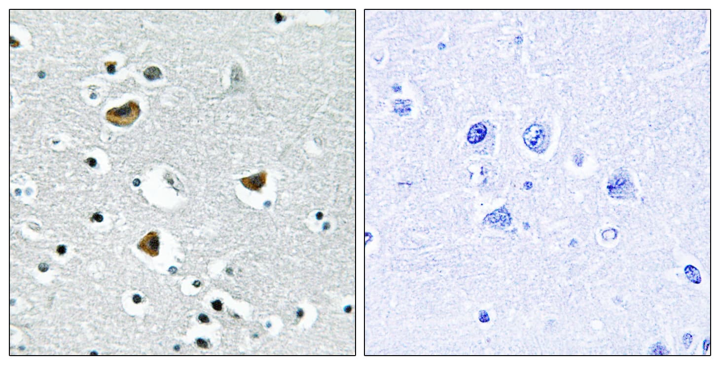 HMGN2 Antibody (aa1-50)