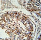 SPACA1 Antibody (aa46-74)