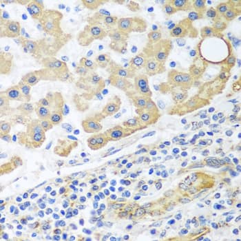 Polyclonal Rabbit anti-Human GLUD1/Glutamate Dehydrogenase Antibody (IHC, WB)