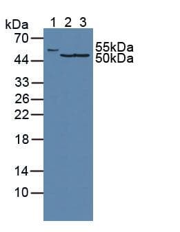 FH / Fumarase / MCL Antibody (aa45-188)