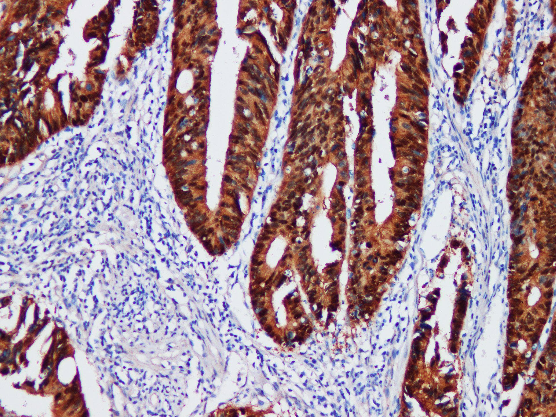 CTNNBL1 / NAP Antibody