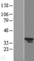 Human SLC25A3 Protein (Over-Expression Lysate Myc-DDK (Flag))