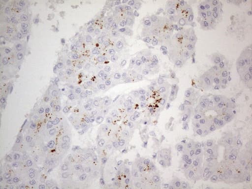 ZNF217 Antibody (aa730-1048, clone OTI2B1)