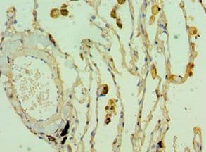 CLEC3B / Tetranectin Antibody (aa22-202)