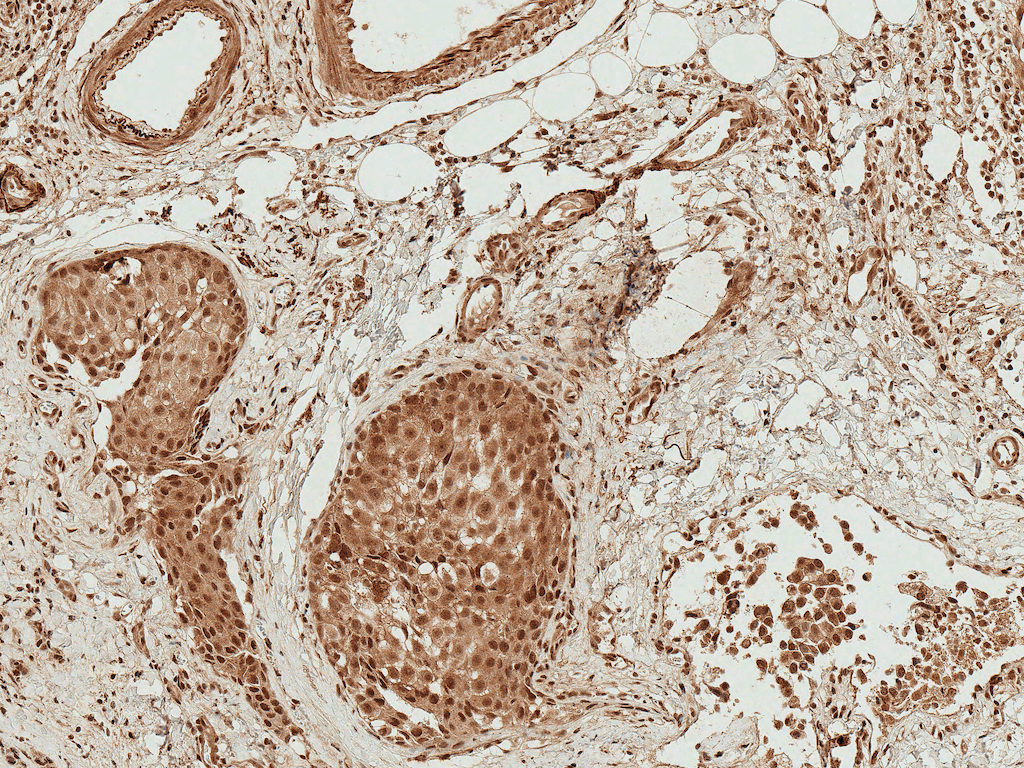 BAD Antibody (RPE)