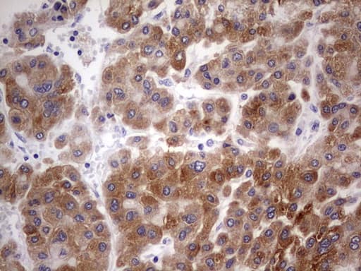 BFSP2 Antibody (aa184-415, clone OTI1D9)