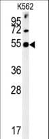 SYT13 Antibody (aa25-52)