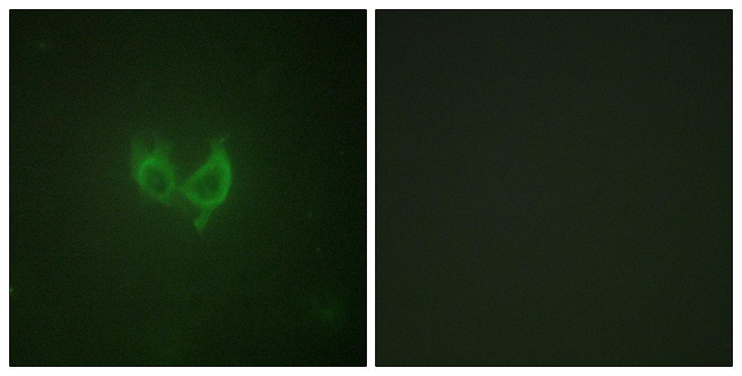 MARK2 Antibody (Ab-596)