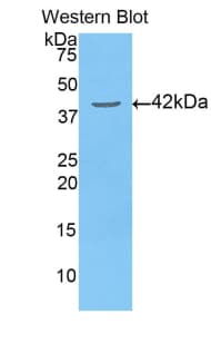 PDHA1 / PDH E1 Alpha Antibody (aa30-390)