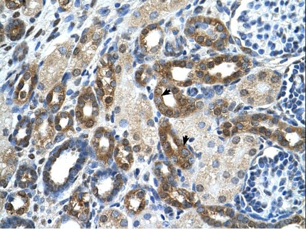 PKLR Antibody (aa56-105)