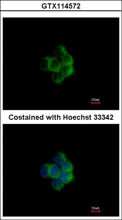 Polyclonal Rabbit anti-Human NDUFA10 Antibody (aa115-355, IHC, WB)