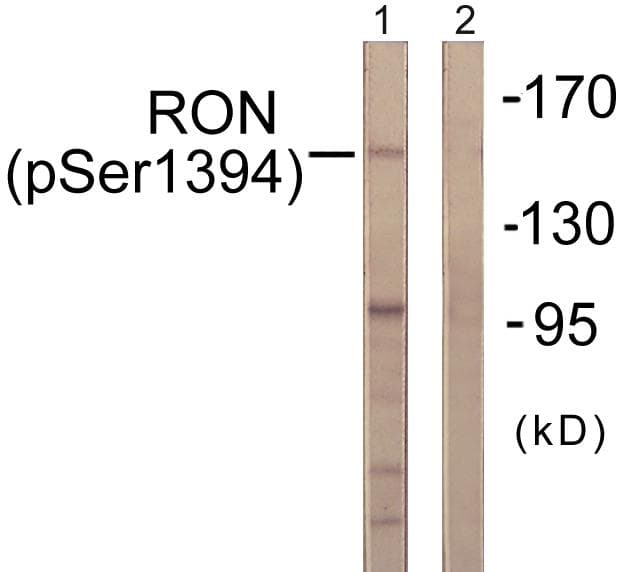 MST1R / RON Antibody (phospho-Ser1394)