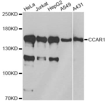 DIS / CCAR1 Antibody