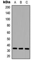 CD20 Antibody (Internal)