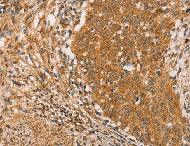 Polyclonal Rabbit anti-Human ARMCX3 Antibody (IHC)