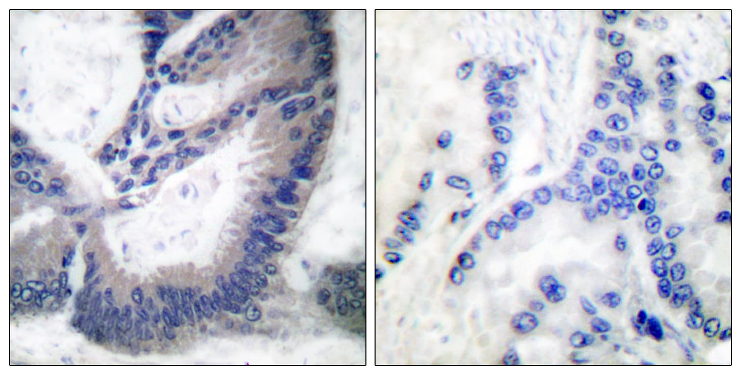 NOS2 / iNOS Antibody (aa1101-1150)