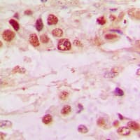 Polyclonal Rabbit anti-Human HDAC7 Antibody (C-Terminus, IHC, WB)