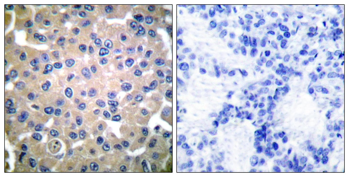 TGM2 / Transglutaminase 2 Antibody