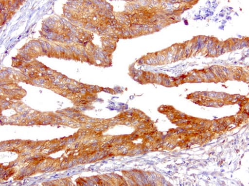 Monoclonal Mouse anti-Human SQSTM1 Antibody (clone UMAB13, IHC, IF, WB)