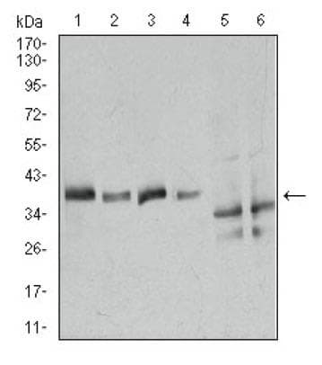 ANXA1 / Annexin A1 Antibody (aa100-300, clone 2F1)